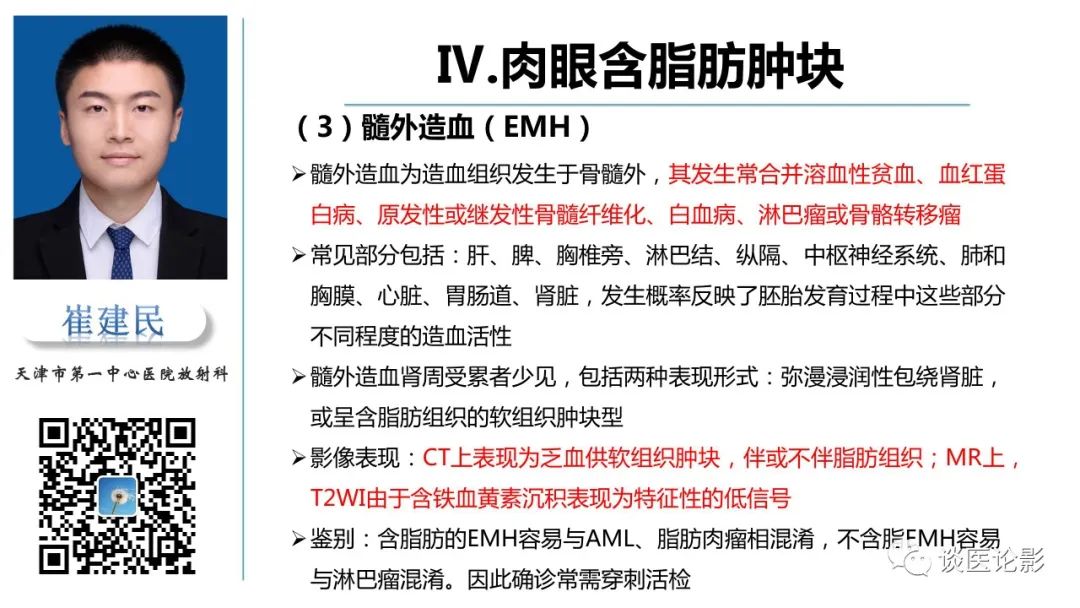 影像PPT - 【PPT】肾周间隙肿瘤性病变影像表现-42 影像PPT - 【PPT】肾周间隙肿瘤性病变影像表现-42