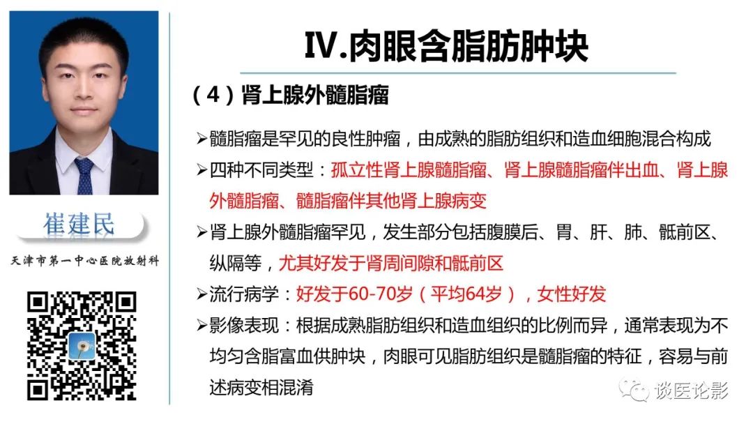 影像PPT - 【PPT】肾周间隙肿瘤性病变影像表现-44 影像PPT - 【PPT】肾周间隙肿瘤性病变影像表现-44