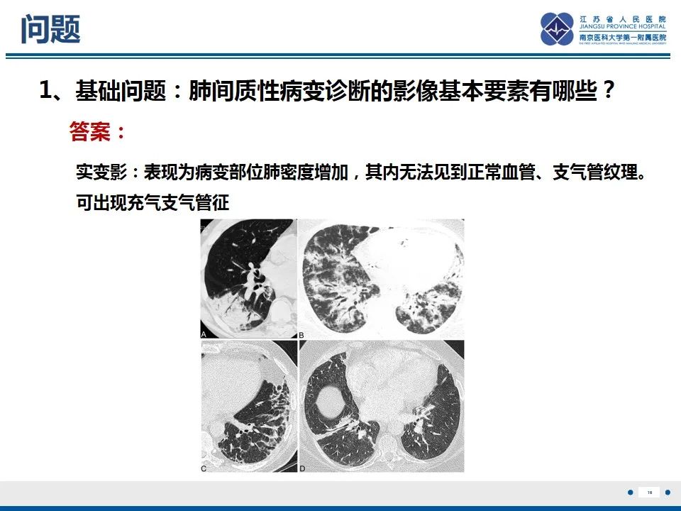 影像PPT - 【PPT】免疫检查点抑制剂相关性肺炎影像表现-17