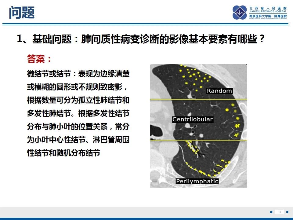 影像PPT - 【PPT】免疫检查点抑制剂相关性肺炎影像表现-15