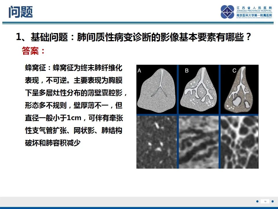 影像PPT - 【PPT】免疫检查点抑制剂相关性肺炎影像表现-14