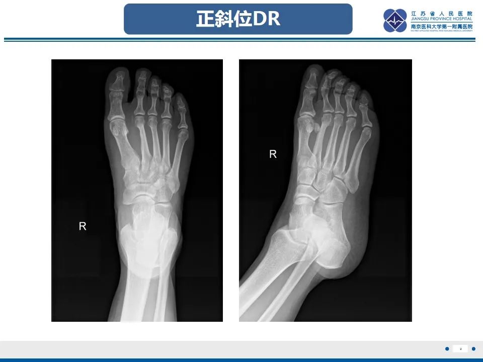 影像PPT - 【PPT】黏液炎性纤维母细胞性肉瘤-3