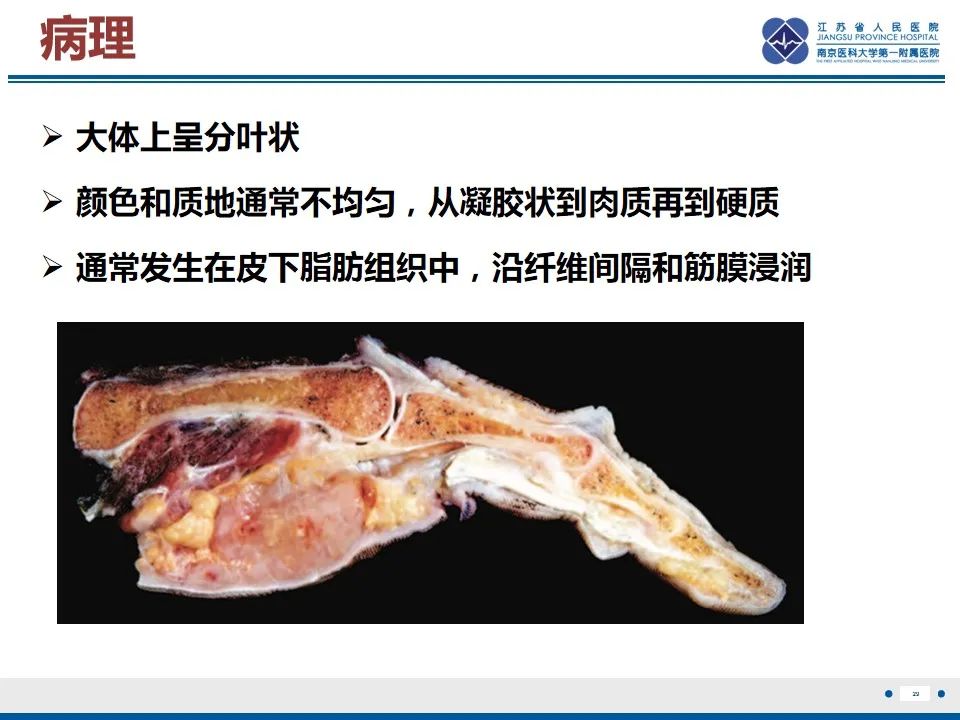影像PPT - 【PPT】黏液炎性纤维母细胞性肉瘤-30