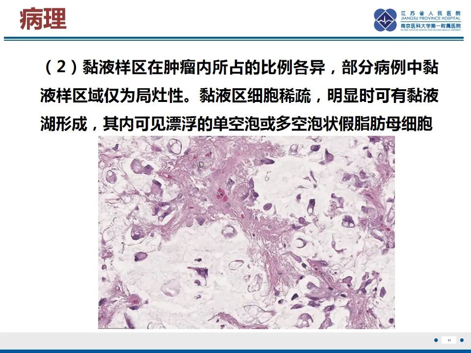 影像PPT - 【PPT】黏液炎性纤维母细胞性肉瘤-32