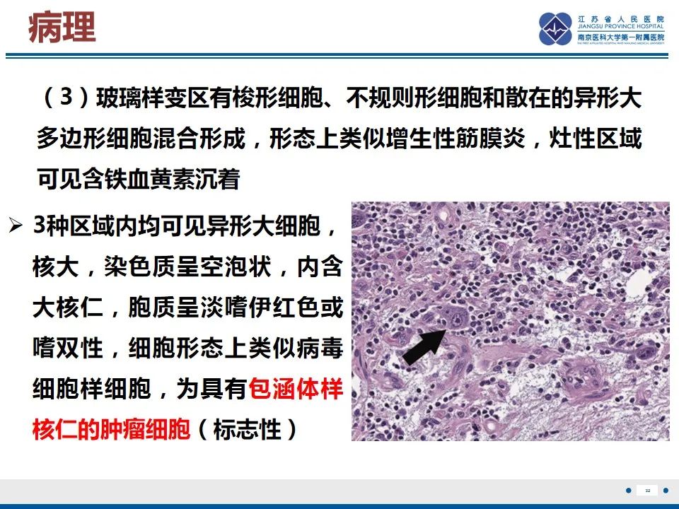 影像PPT - 【PPT】黏液炎性纤维母细胞性肉瘤-33