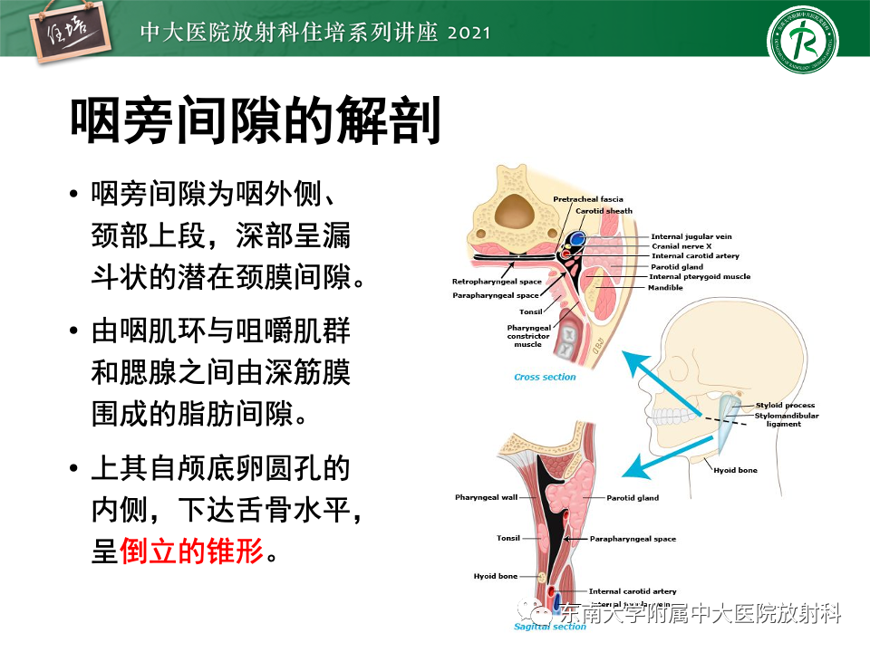 影像PPT - 【PPT】咽旁间隙肿瘤的定位与诊断-8