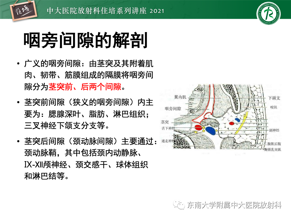 影像PPT - 【PPT】咽旁间隙肿瘤的定位与诊断-10