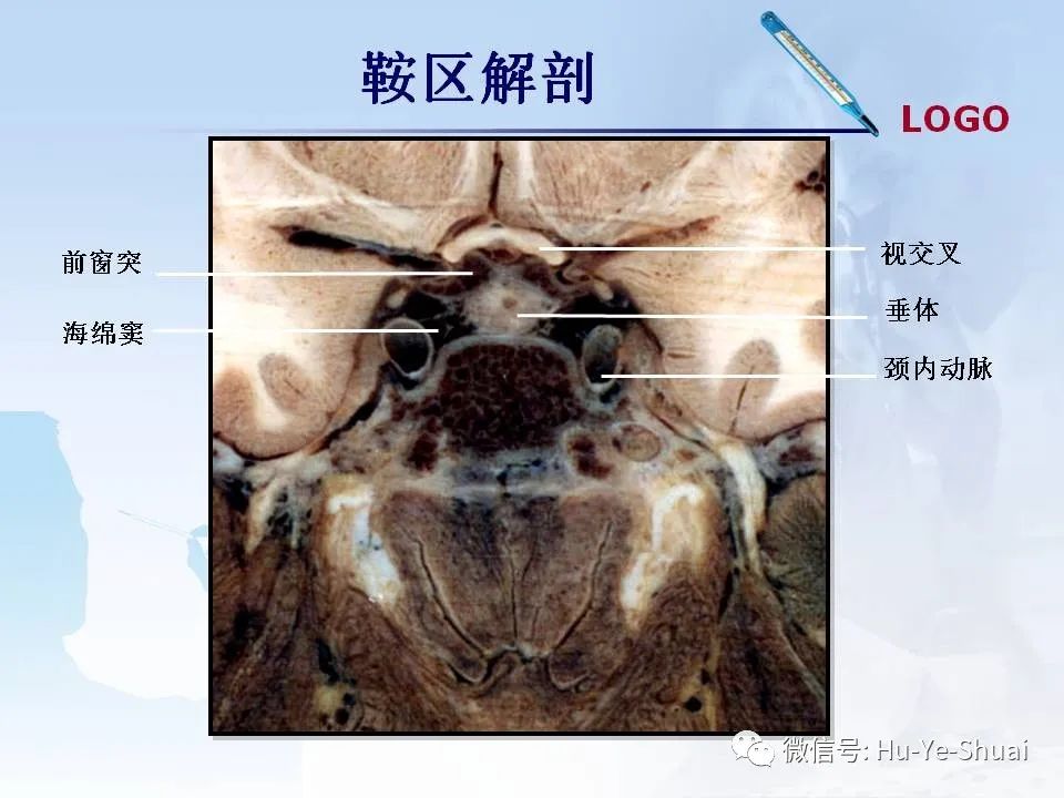 影像PPT - 【PPT】鞍区肿瘤的MRI诊断-3