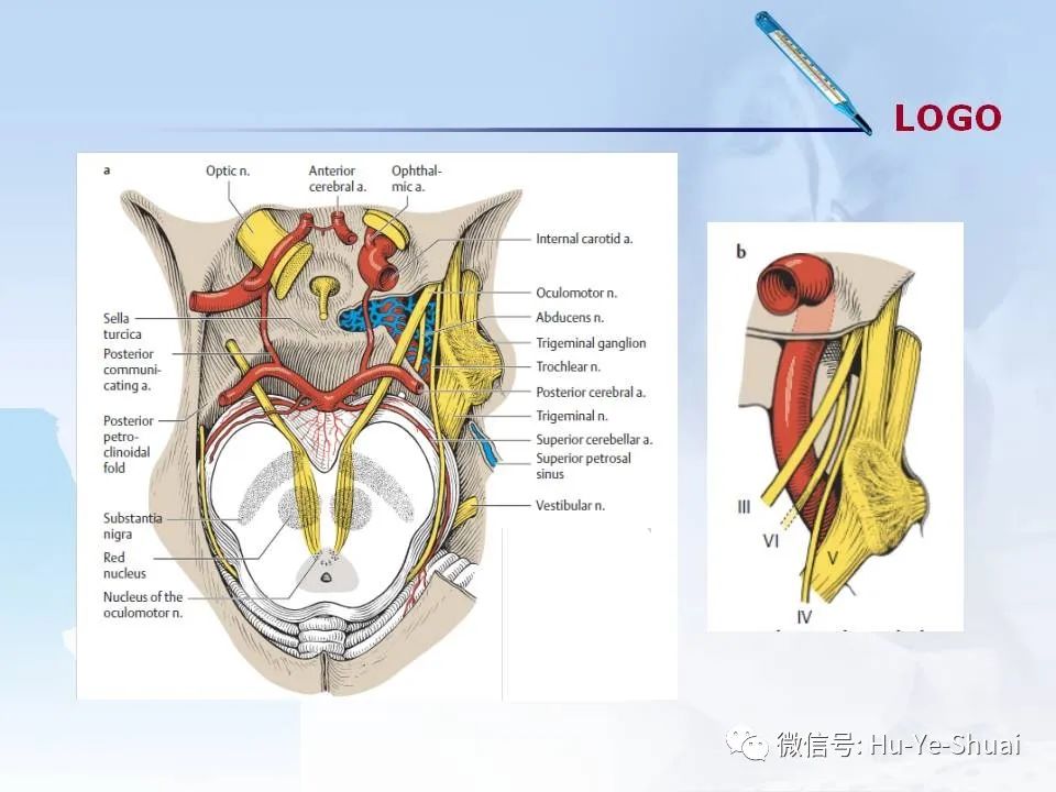 影像PPT - 【PPT】鞍区肿瘤的MRI诊断-4