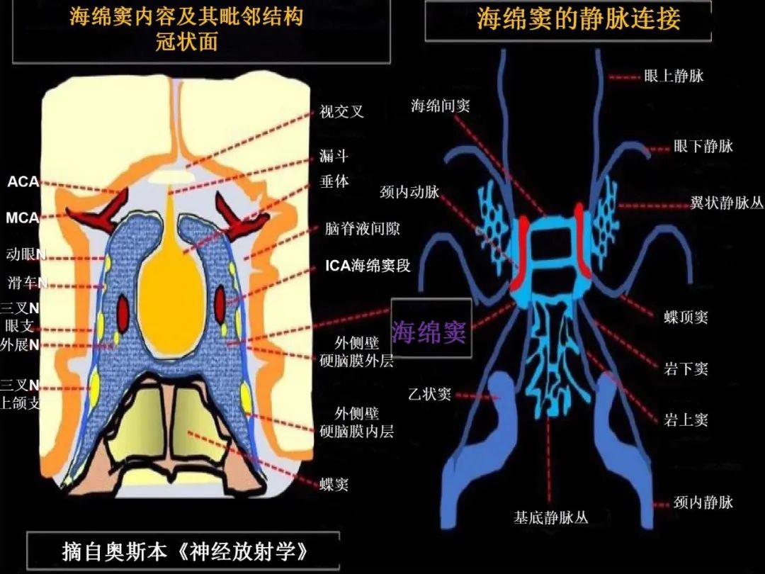 影像PPT - 【PPT】中枢神经系统血管病变—海绵窦影像病理对照-5