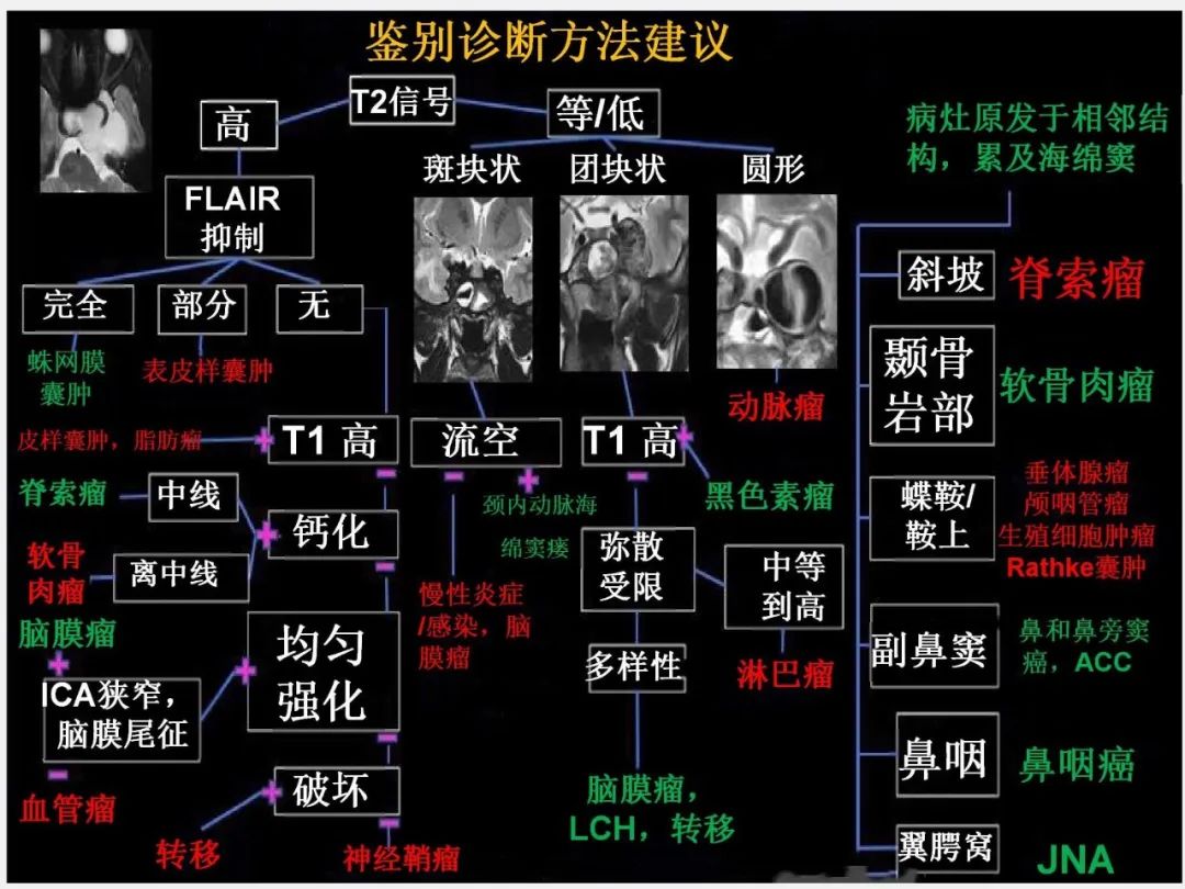 影像PPT - 【PPT】中枢神经系统血管病变—海绵窦影像病理对照-71