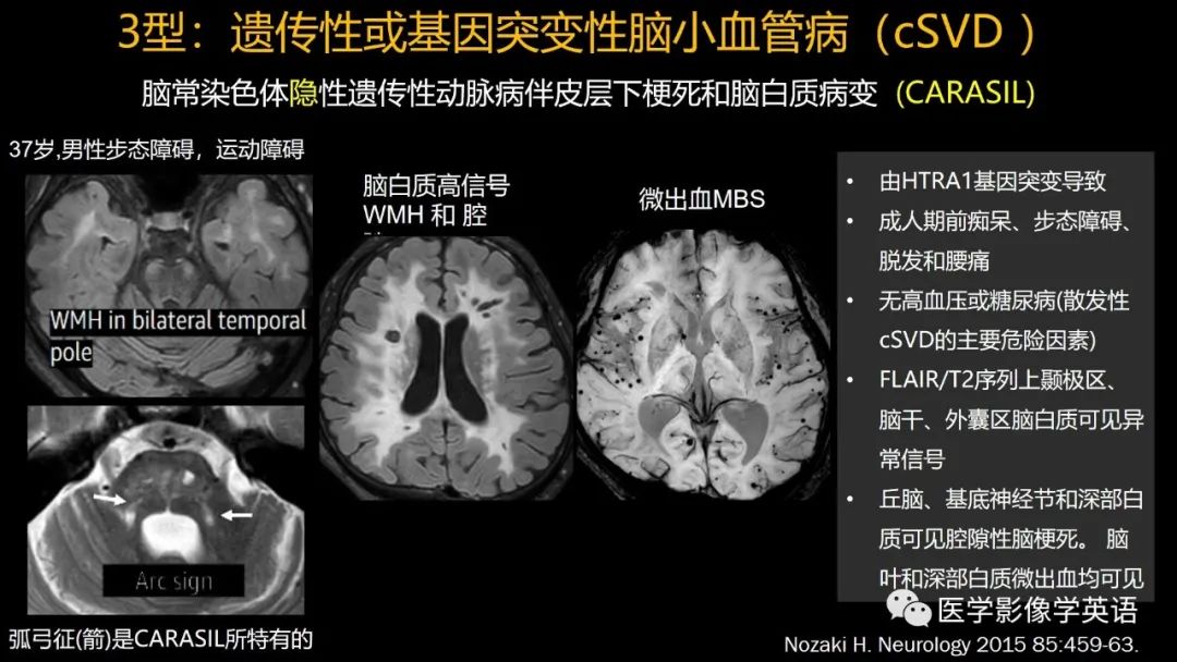 影像PPT - 【PPT】脑小血管病： 放射科医生须知-38