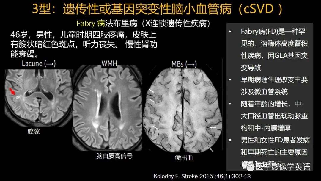 影像PPT - 【PPT】脑小血管病： 放射科医生须知-40