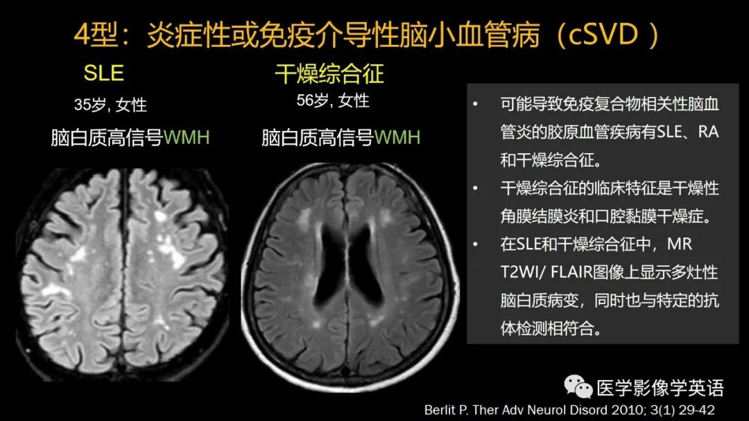影像PPT - 【PPT】脑小血管病： 放射科医生须知-44