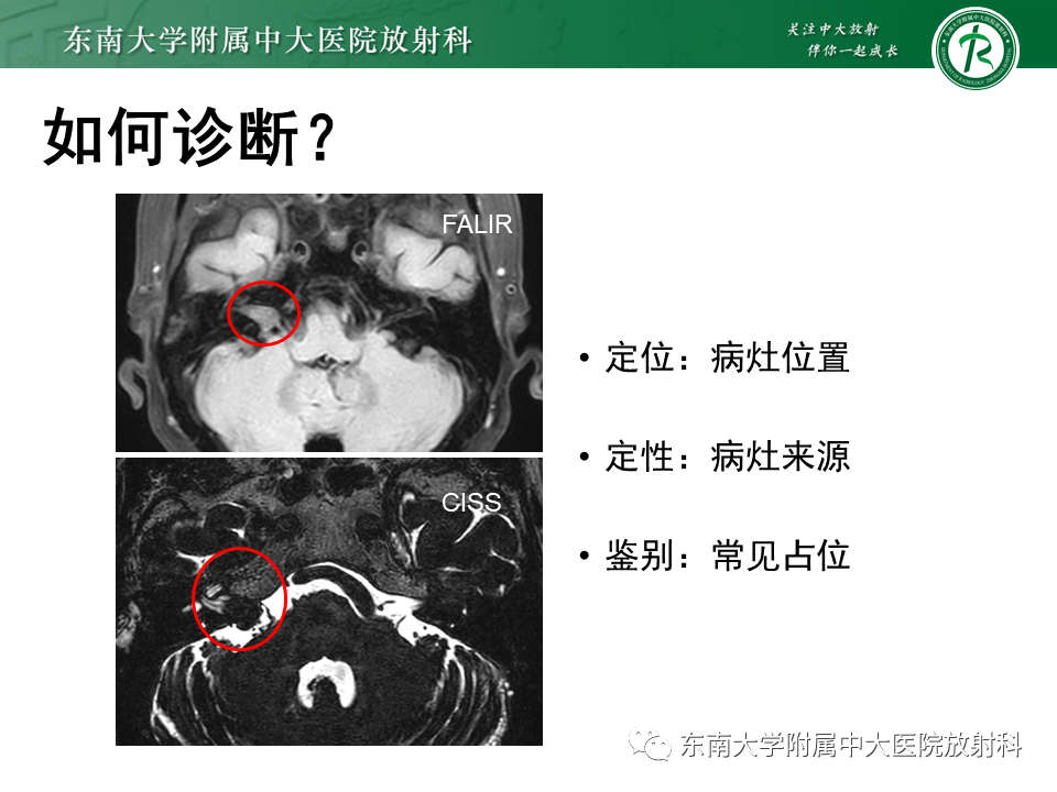 影像PPT - 【PPT】成人桥小脑角区常见肿瘤-5