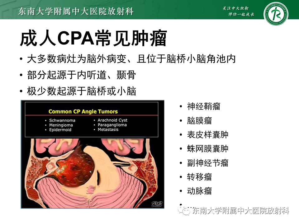 影像PPT - 【PPT】成人桥小脑角区常见肿瘤-10