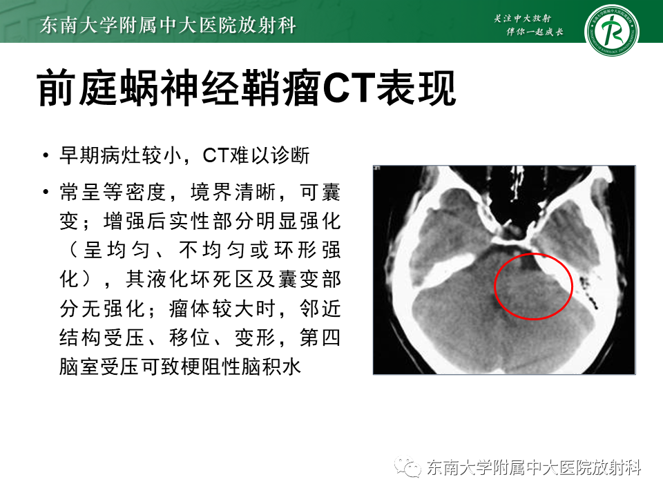 影像PPT - 【PPT】成人桥小脑角区常见肿瘤-15