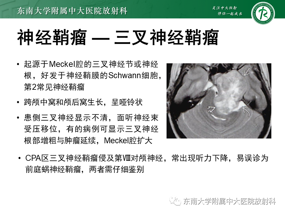 影像PPT - 【PPT】成人桥小脑角区常见肿瘤-19