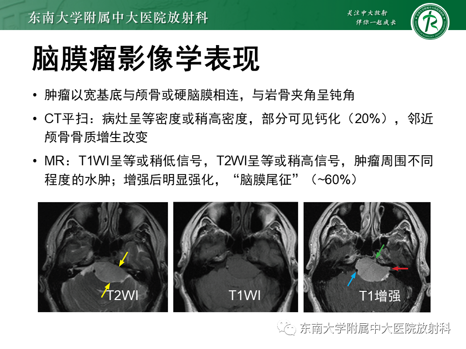 影像PPT - 【PPT】成人桥小脑角区常见肿瘤-23
