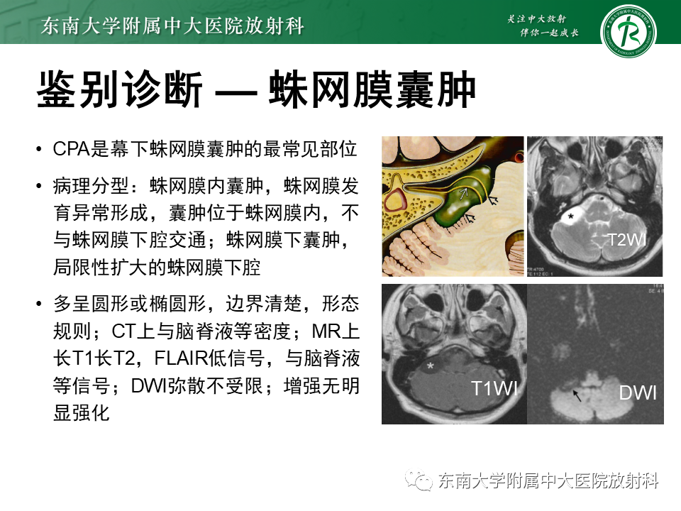 影像PPT - 【PPT】成人桥小脑角区常见肿瘤-28