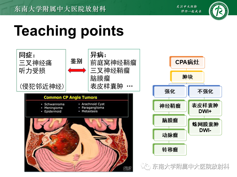 影像PPT - 【PPT】成人桥小脑角区常见肿瘤-30