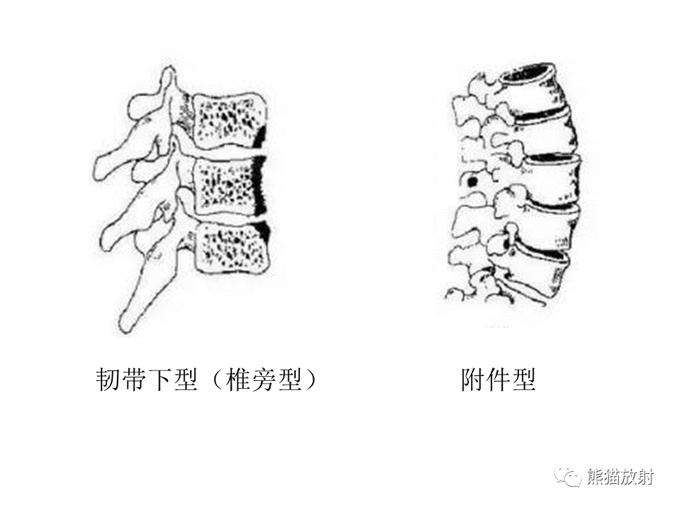 影像PPT - 【PPT】脊柱结核2例CT及MR影像-47