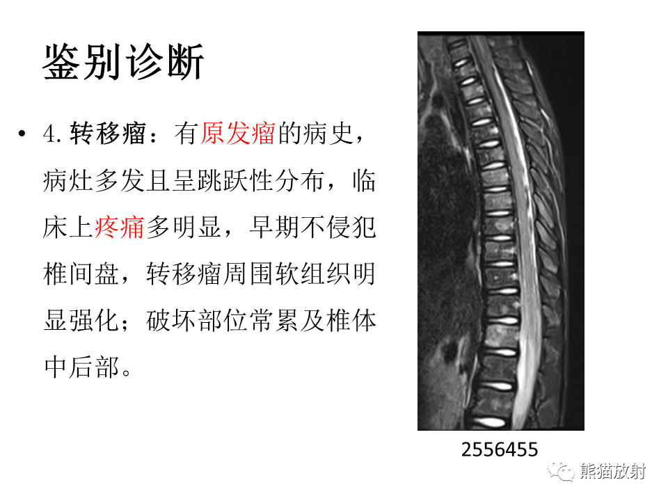 影像PPT - 【PPT】脊柱结核2例CT及MR影像-61