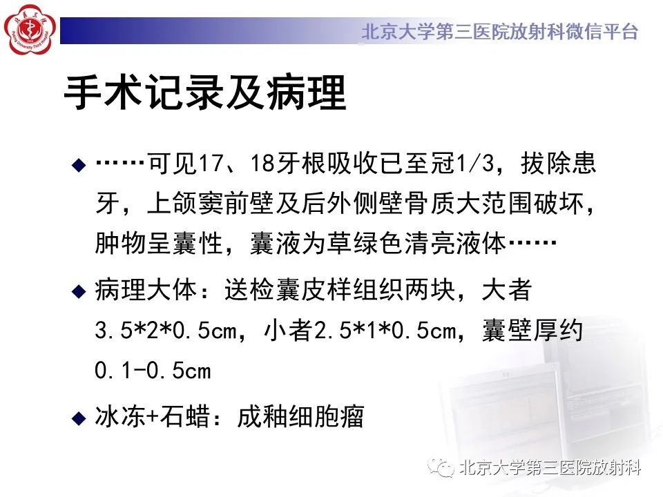 影像PPT - 【PPT】成釉细胞瘤-12