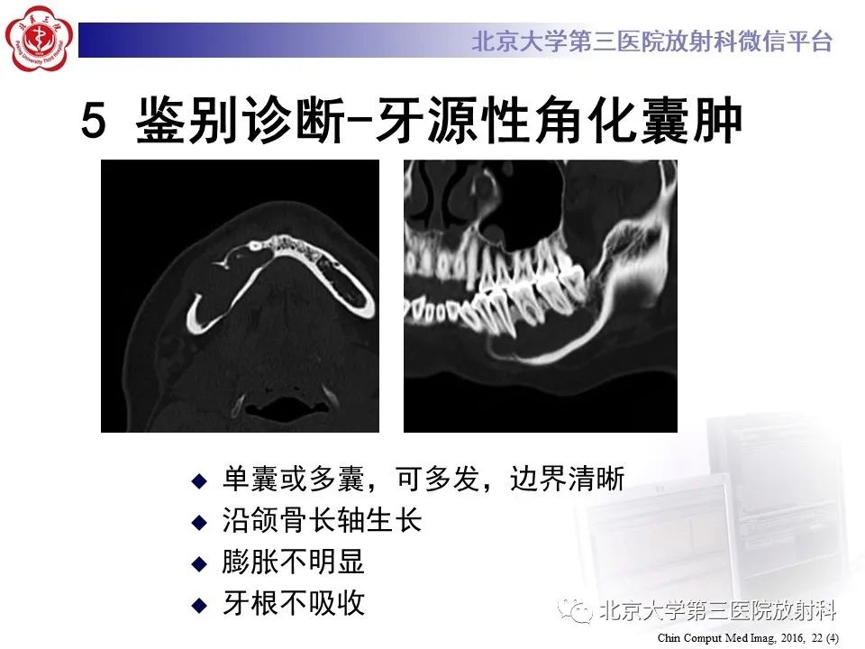 影像PPT - 【PPT】成釉细胞瘤-38