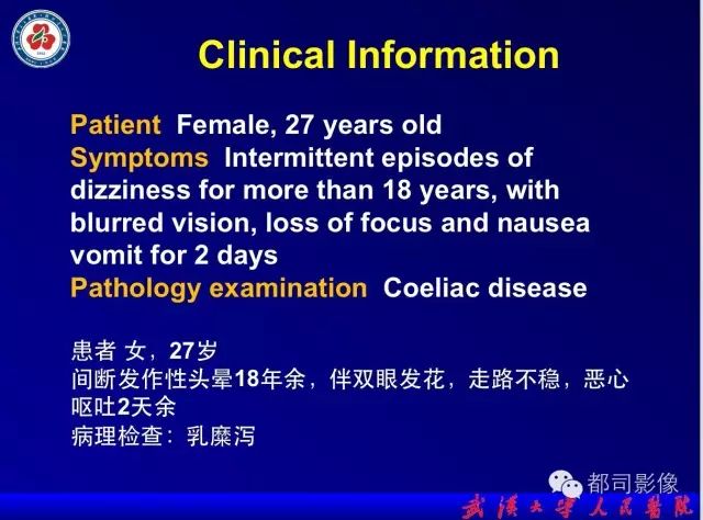 影像PPT - 【PPT】乳糜泻-癫痫-脑钙化综合征-2