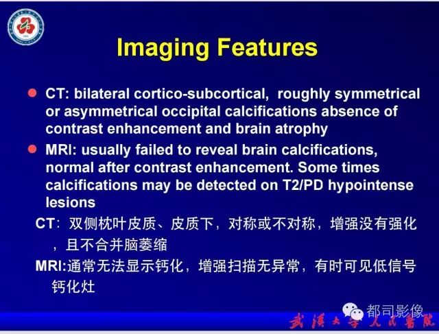 影像PPT - 【PPT】乳糜泻-癫痫-脑钙化综合征-16