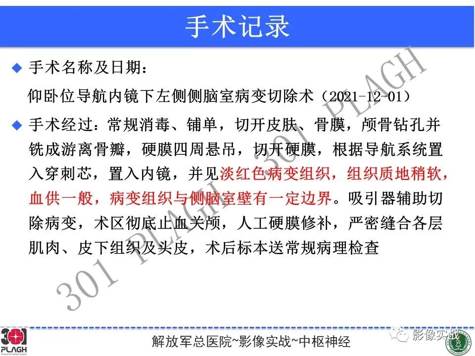 影像PPT - 【病例】中枢神经细胞瘤1例MR影像-24