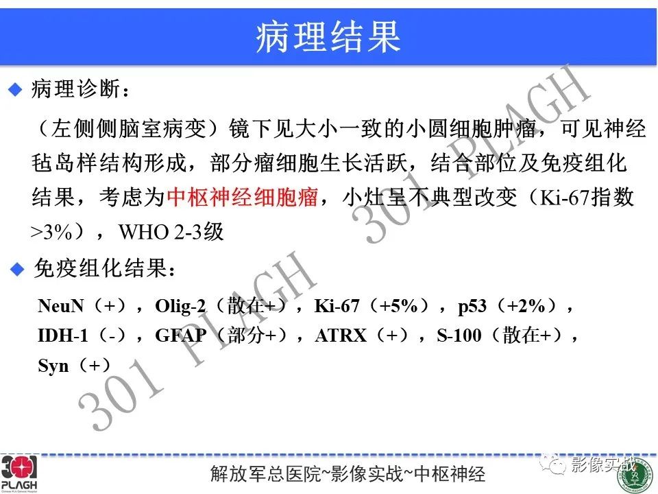 影像PPT - 【病例】中枢神经细胞瘤1例MR影像-25