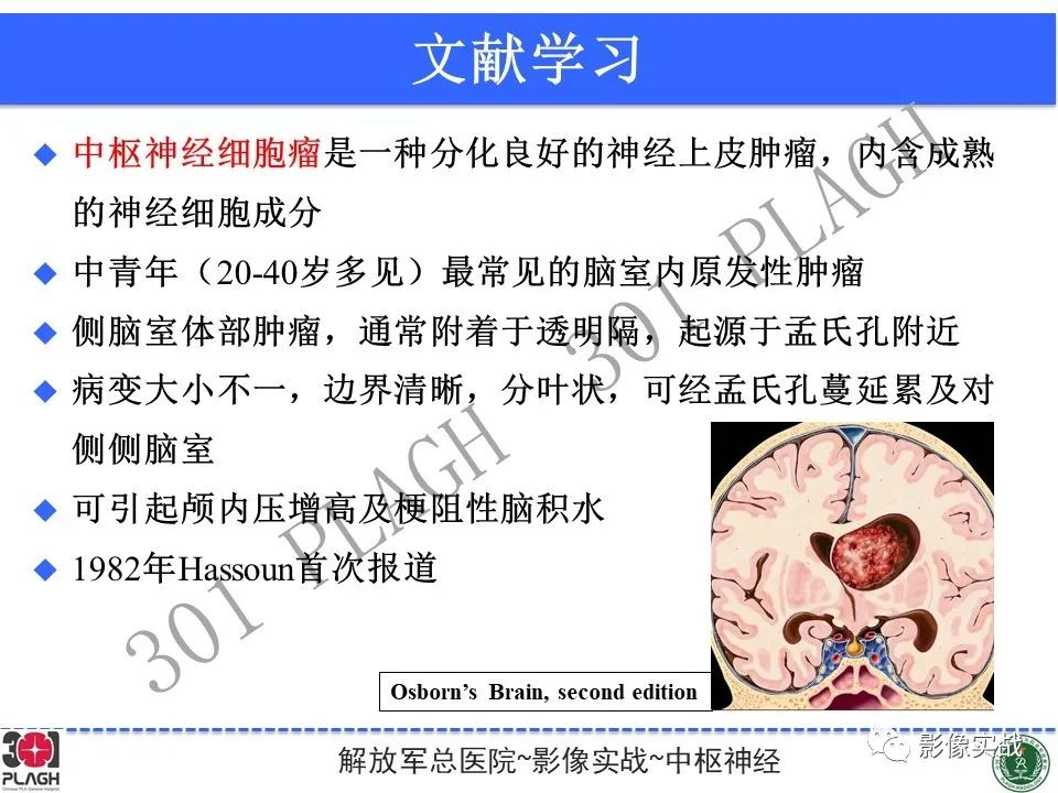 影像PPT - 【病例】中枢神经细胞瘤1例MR影像-26