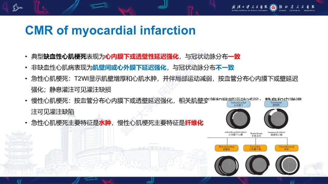 影像PPT - 【PPT】冠状动脉非阻塞性心肌梗死影像诊断-14