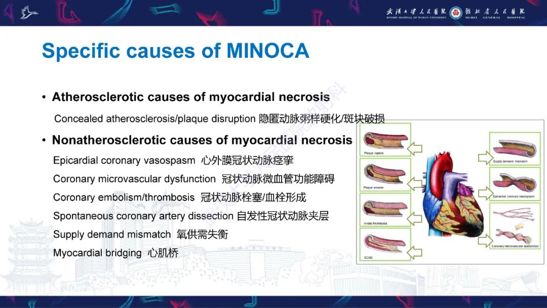 影像PPT - 【PPT】冠状动脉非阻塞性心肌梗死影像诊断-16