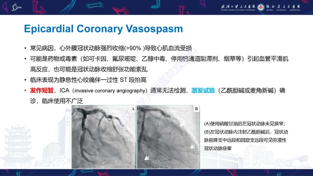 影像PPT - 【PPT】冠状动脉非阻塞性心肌梗死影像诊断-20
