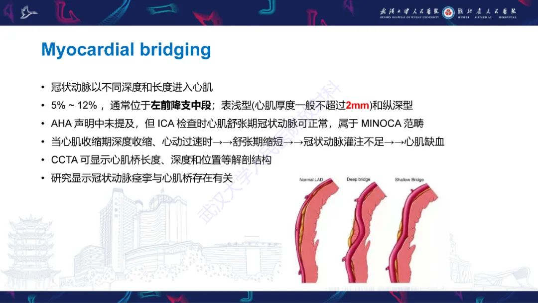 影像PPT - 【PPT】冠状动脉非阻塞性心肌梗死影像诊断-29