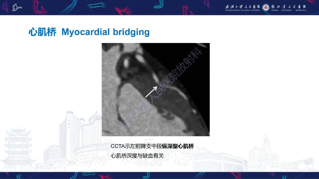 影像PPT - 【PPT】冠状动脉非阻塞性心肌梗死影像诊断-30