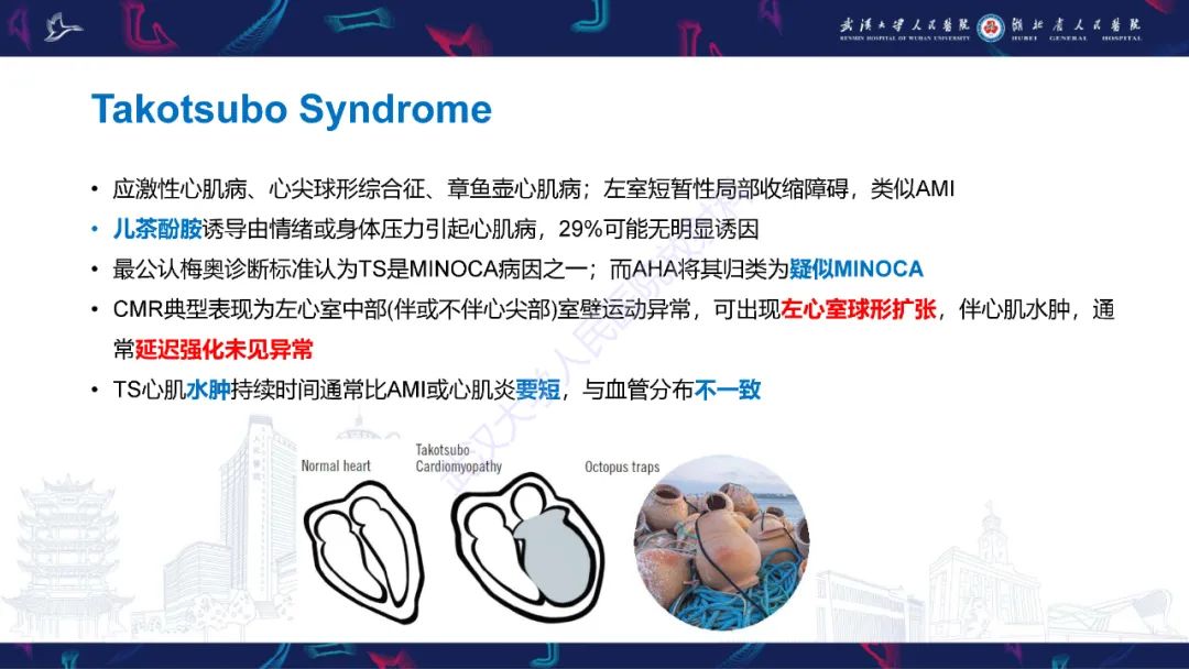 影像PPT - 【PPT】冠状动脉非阻塞性心肌梗死影像诊断-33