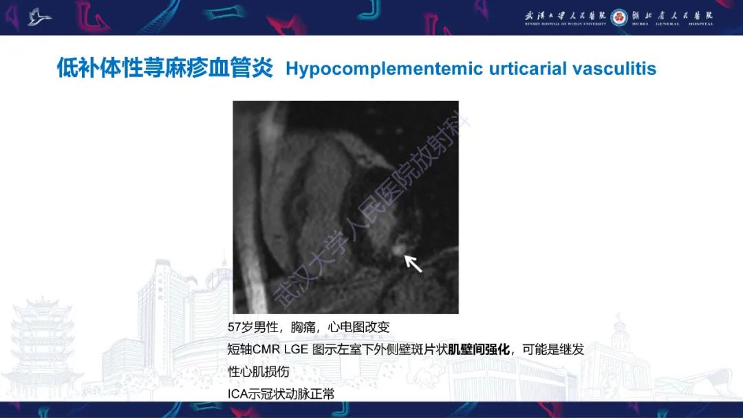 影像PPT - 【PPT】冠状动脉非阻塞性心肌梗死影像诊断-43
