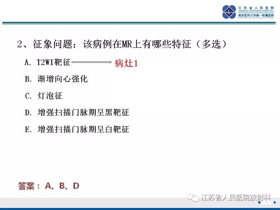 影像PPT - 【PPT】肝上皮样血管内皮瘤-10