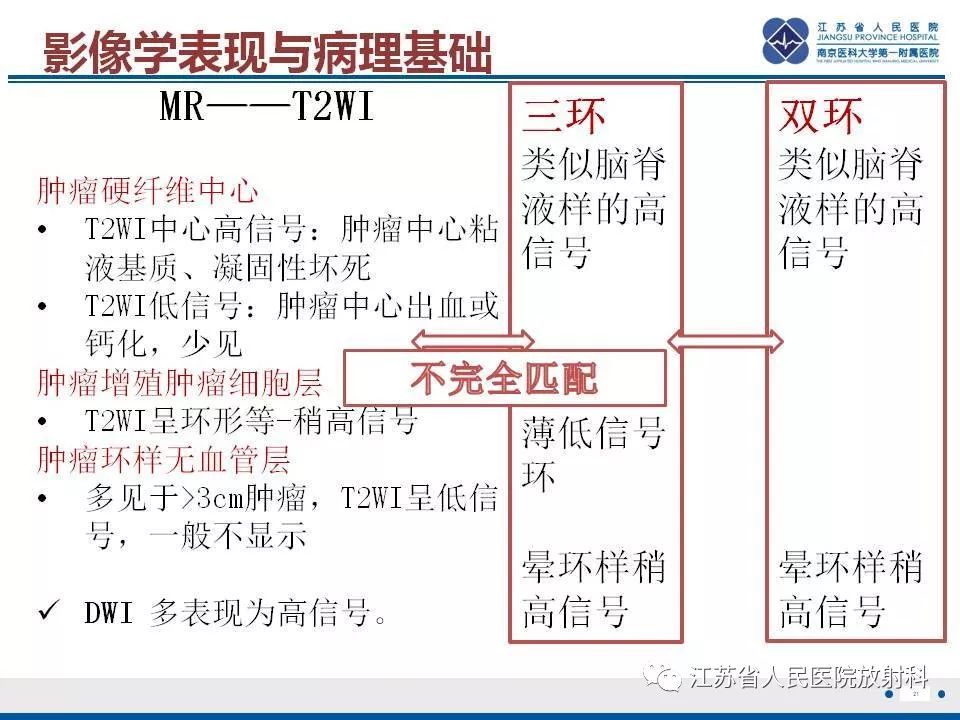 影像PPT - 【PPT】肝上皮样血管内皮瘤-22