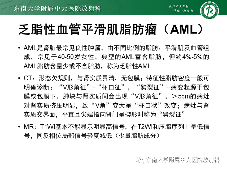 影像PPT - 【PPT】肾嫌色细胞癌-25