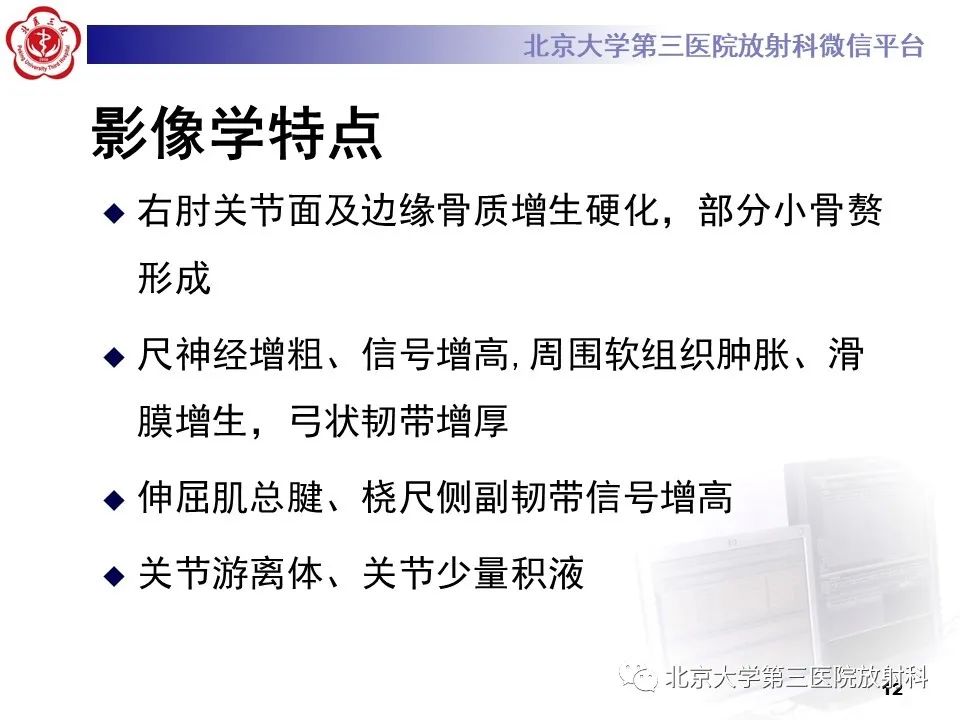 影像PPT - 【PPT】肘管综合征-11