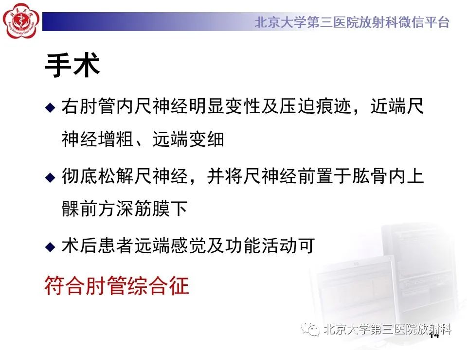 影像PPT - 【PPT】肘管综合征-13