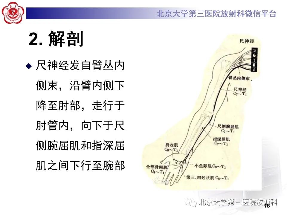 影像PPT - 【PPT】肘管综合征-17