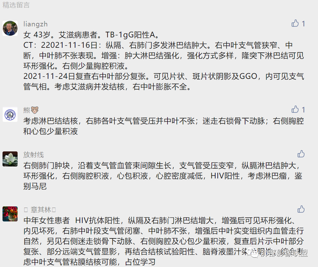 影像PPT - 【病例】诡异多变的结核-31 影像PPT - 【病例】诡异多变的结核-31
