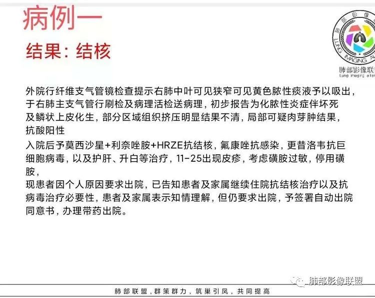 影像PPT - 【病例】诡异多变的结核-37 影像PPT - 【病例】诡异多变的结核-37