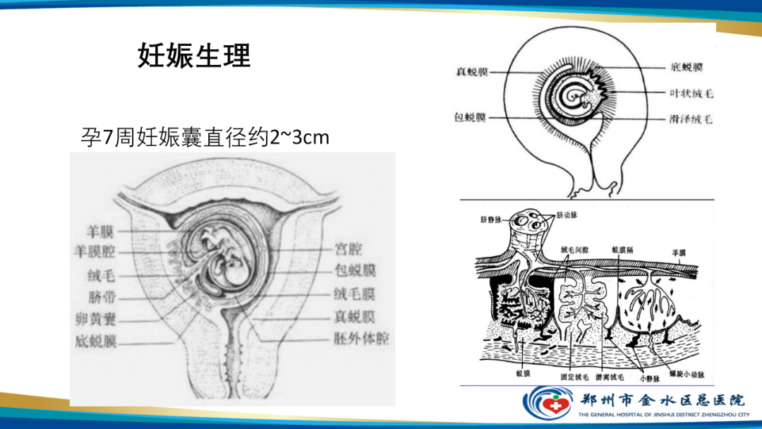 影像PPT - 【病例】瘢痕妊娠1例MR影像-28